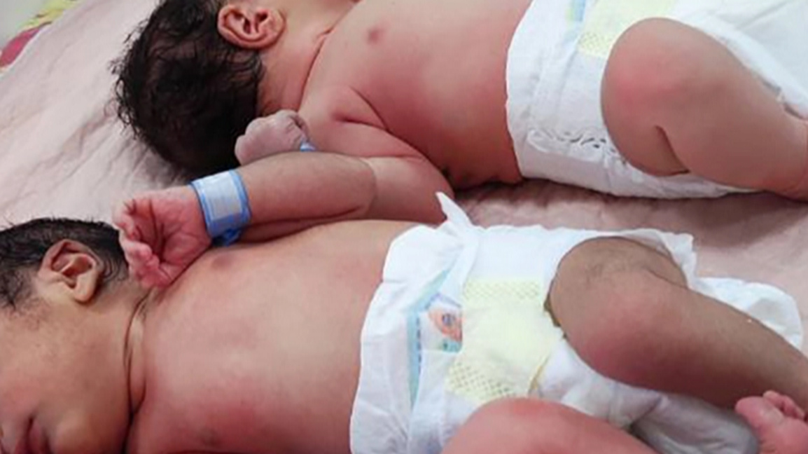 Болницата в Гоце Делчев се нуждае от нова апаратура