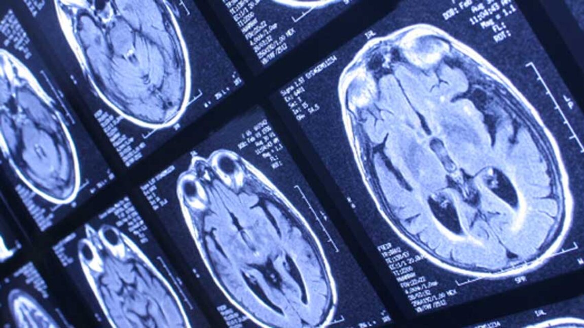 Д-р Веселин Герев: Протестът на работещите в психиатрични болници няма да има резултат