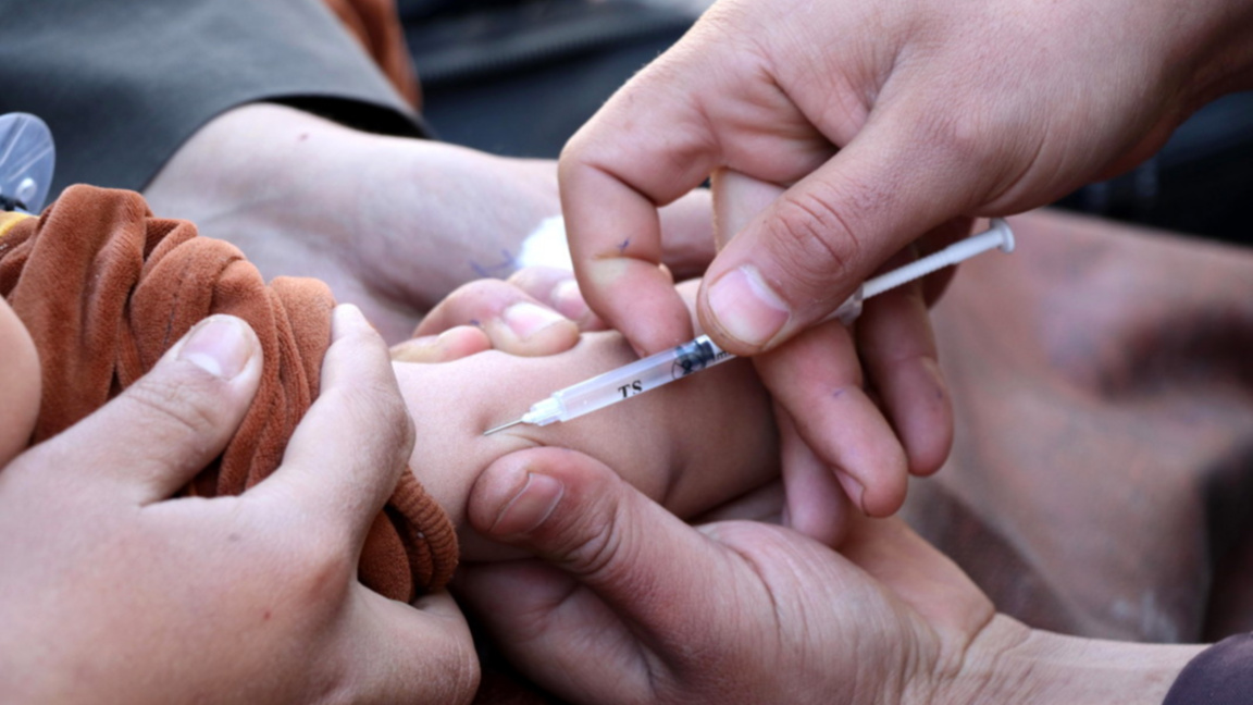 В Ловешко нарастват случаите на морбили...