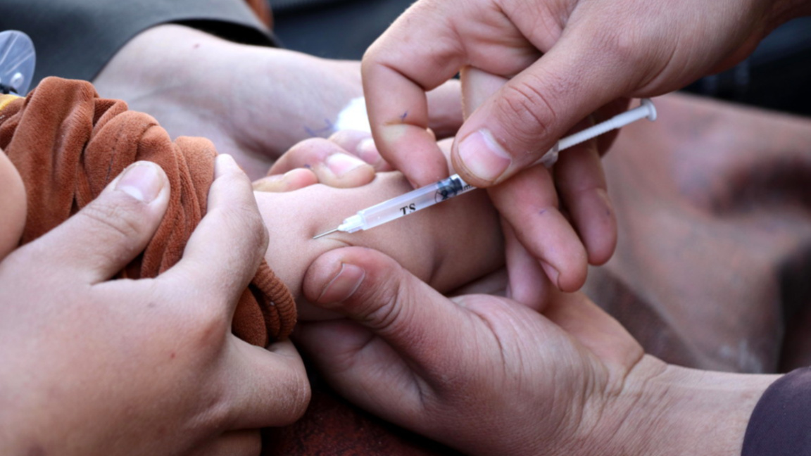 МЗ: Случаите на морбили в страната към 1...