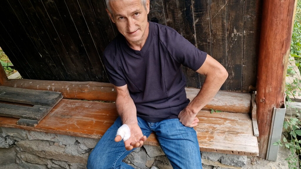 Нападнатият от мечка мъж от село Лясково: Кучето ме спаси!