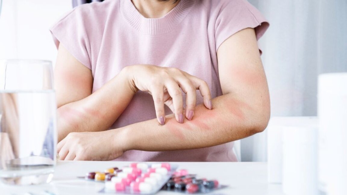 Алергията – болест на съвремието